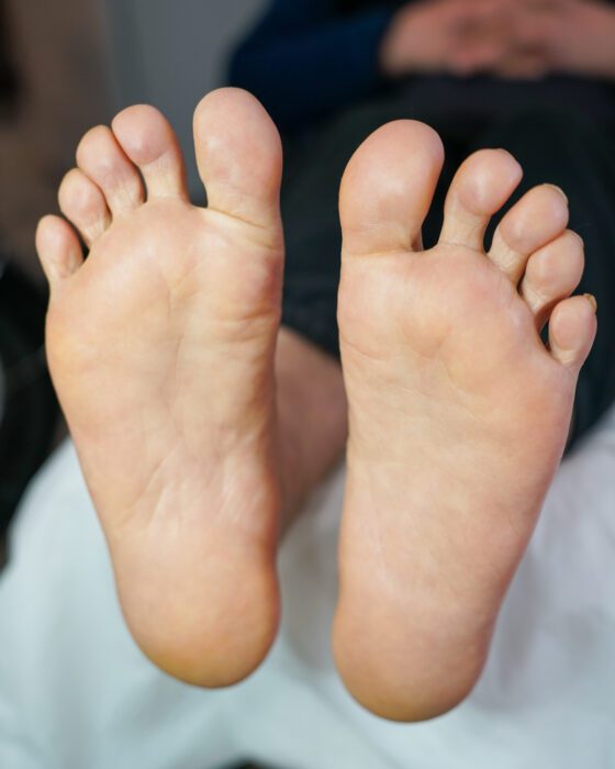 After: the same soles, smooth and even, with the flaking gone.