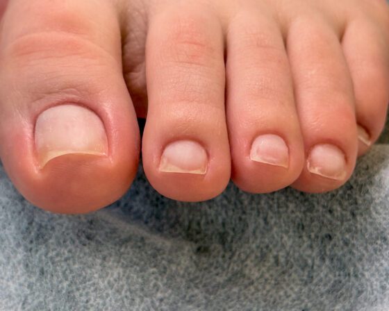 Toenails after preparation, shaped and cleaned, before any colour goes on.