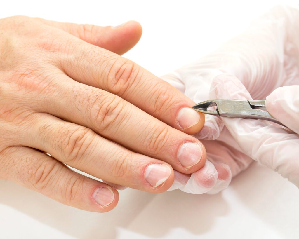 Cuticle nippers trimming the cuticle on a man hand with short natural nails