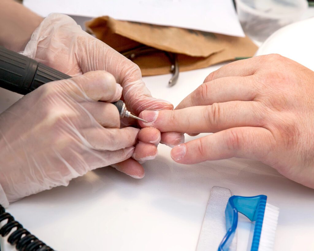 A gloved technician using an electric file on a man's fingernail at a treatment table