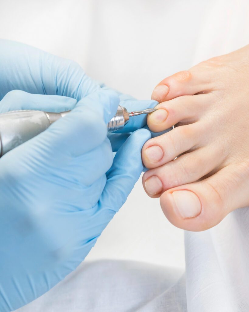 Technician in blue gloves shaping a toenail with a rotary file