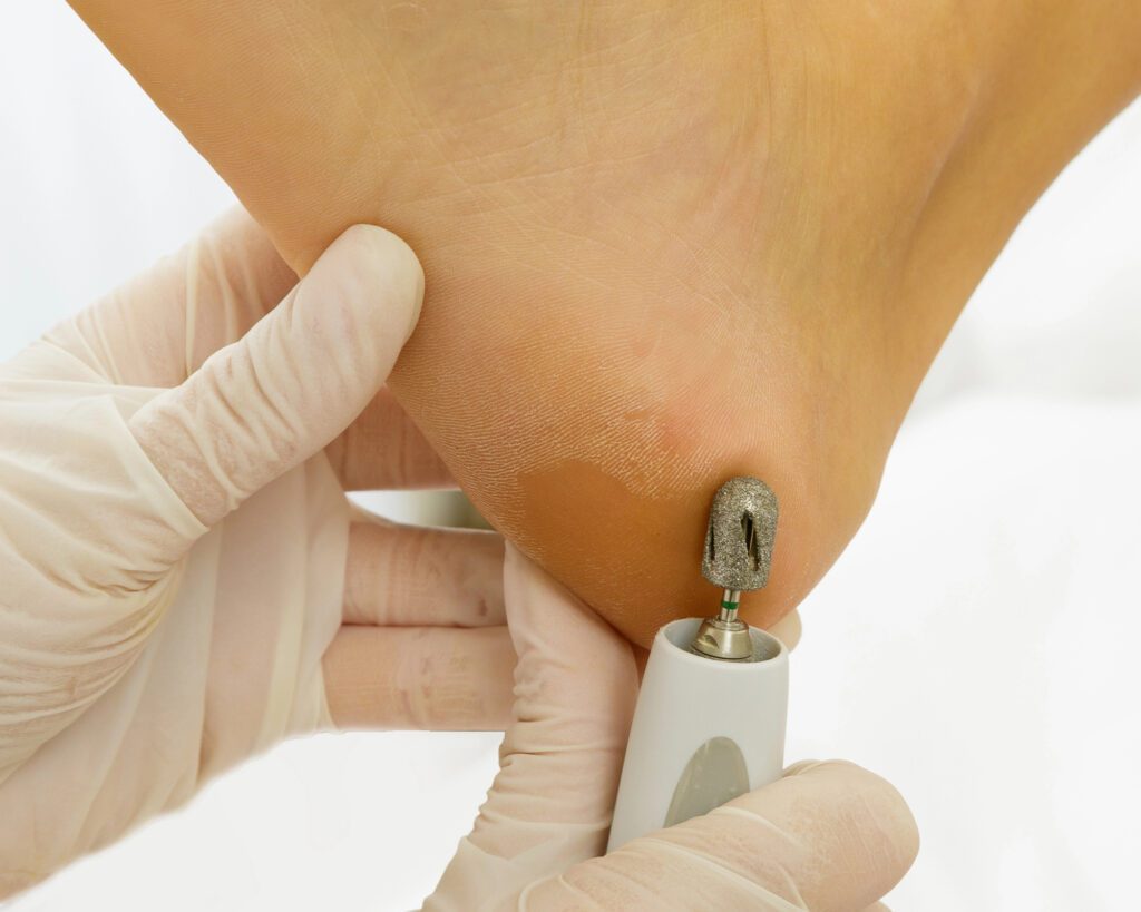 Technician in white gloves smoothing a dry heel with a diamond-coated rotary cap