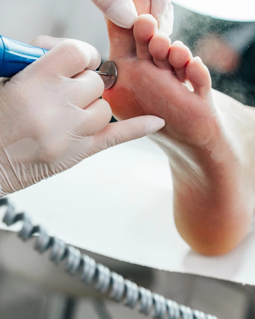 Technician in gloves smoothing the ball of a foot with a rotary pedicure disc